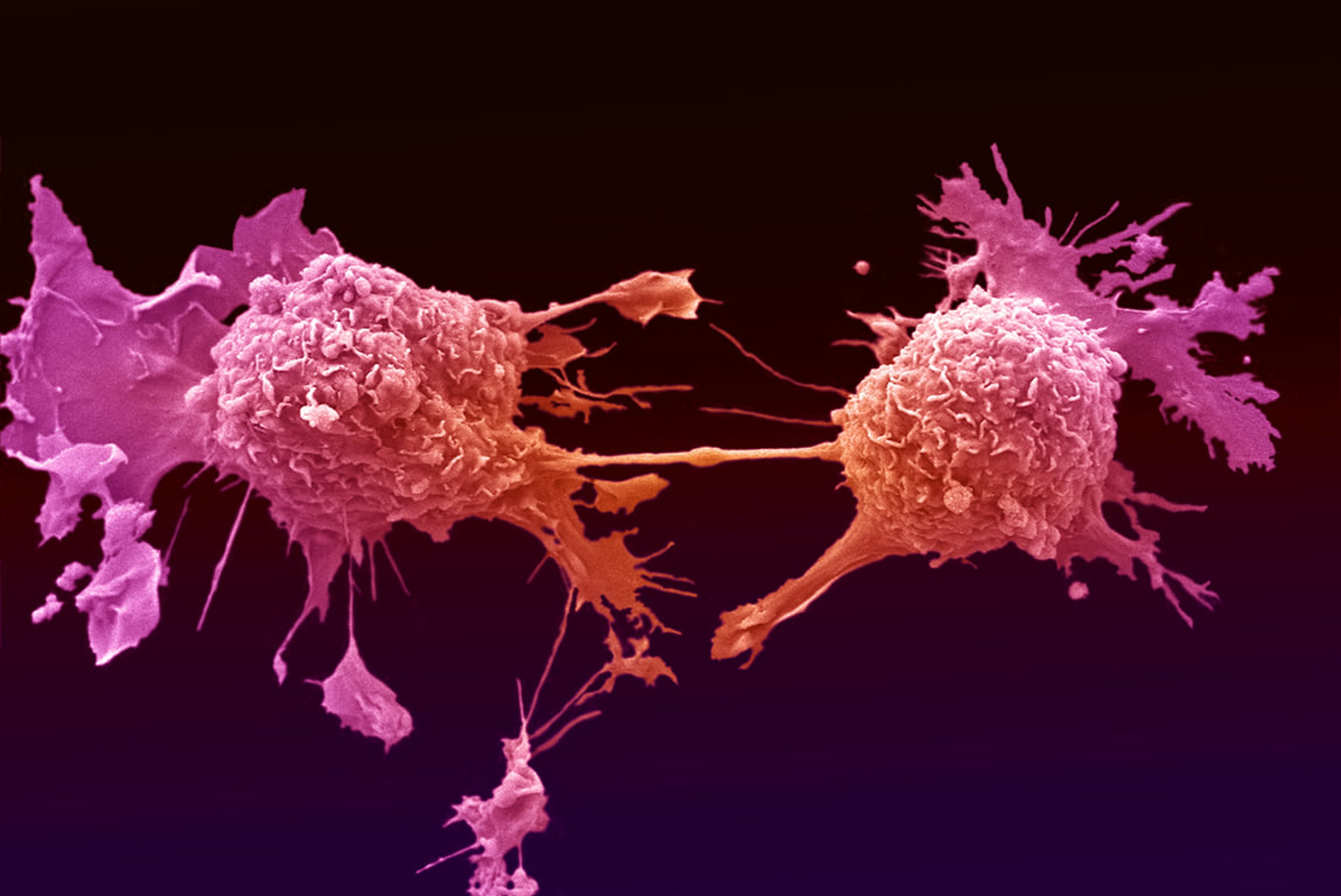 Google is working on AI-enhanced microscope for cancer detection