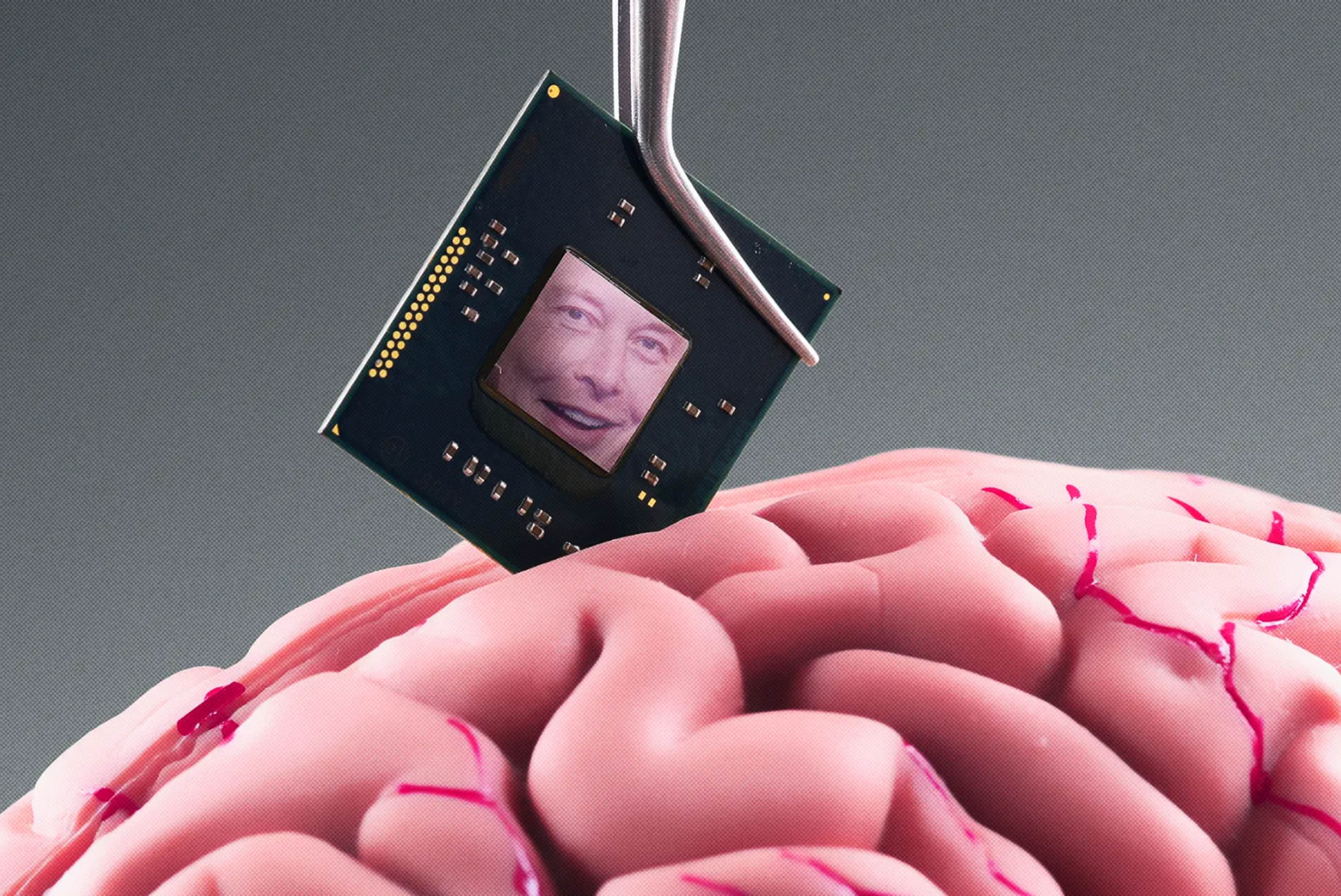 Neuralink marks milestone as Elon Musk announces successful brain chip implant in human
