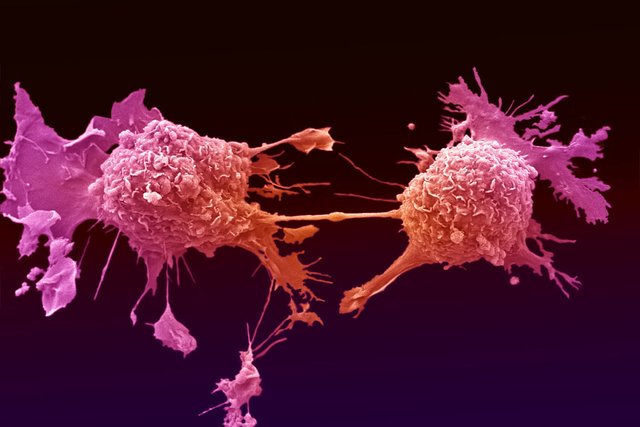 Google is working on AI-enhanced microscope for cancer detection