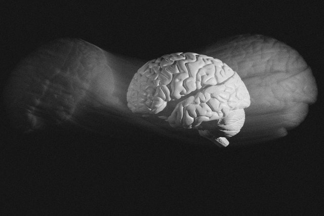 Researcher explores replacing parts of brain with cloned brain tissue to beat aging