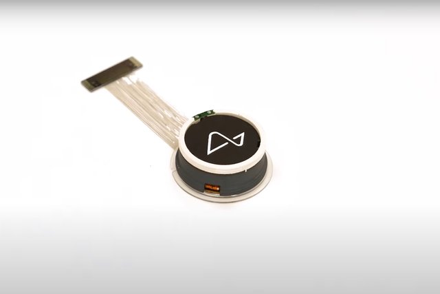 Neuralink aims to implant 20,000 brain chips annually and hit $1B in revenue by 2031
